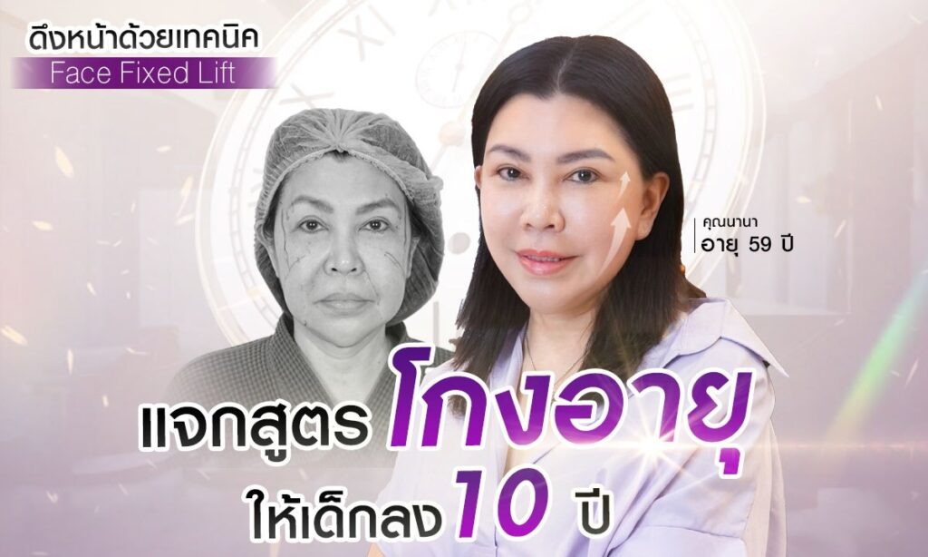 แจกสูตรโกงอายุให้เด็กลง 10 ปี