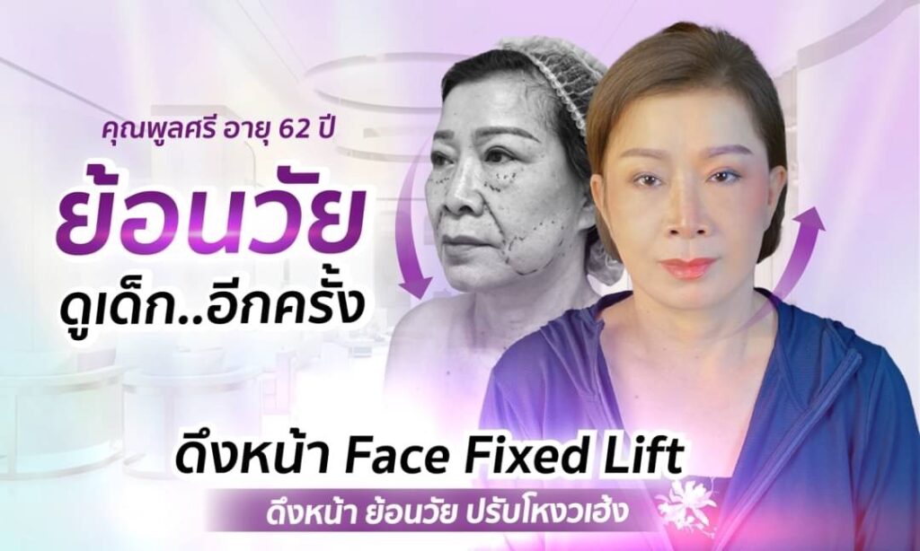 S 29753388 0 แม่พูลศรี ดึงหน้าย้อนวัยจากป้า 62 เป็นสาว 40