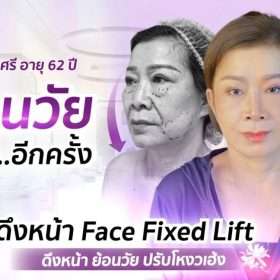 แม่พูลศรี ดึงหน้า ย้อนวัยจากป้า 62 เป็นสาว 40