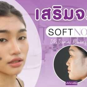 ปรับทรงจมูกให้หน้าดูสวยหวานตั้งแต่ครั้งแรก Soft Nose