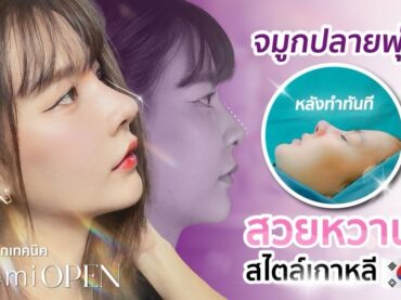 S 30367776 แก้จมูกแบบเซมิโอเพ่น semi open ปรับหน้าแข็งให้ดูหวานในพริบตา