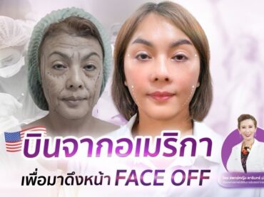 S 31211528 ศัลยกรรมดึงหน้า Face Fixed lift เทคนิค Double lock