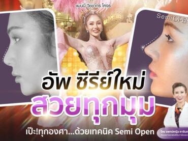 S 31211531 เสริมจมูก Semi Open LGBQ ปรับโครงหน้า เติมเสน่ห์ให้ใบหน้า