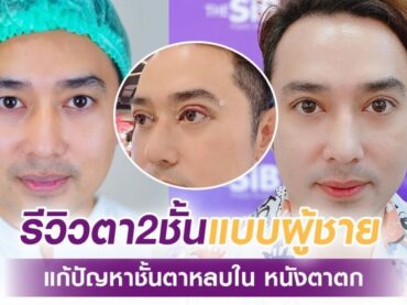 S 34922510 เปลี่ยนตาเศร้าให้เป็นตาหวานในพริบตา