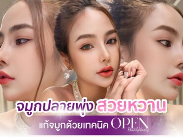 เสริมจมูกOPEN 01 แก้จมูกแบบโอเพ่นปรับโครงสร้างจมูกรองด้วยกระดูกอ่อนหลังหู เทคนิคพิเศษที่เดอะซิบคลินิก