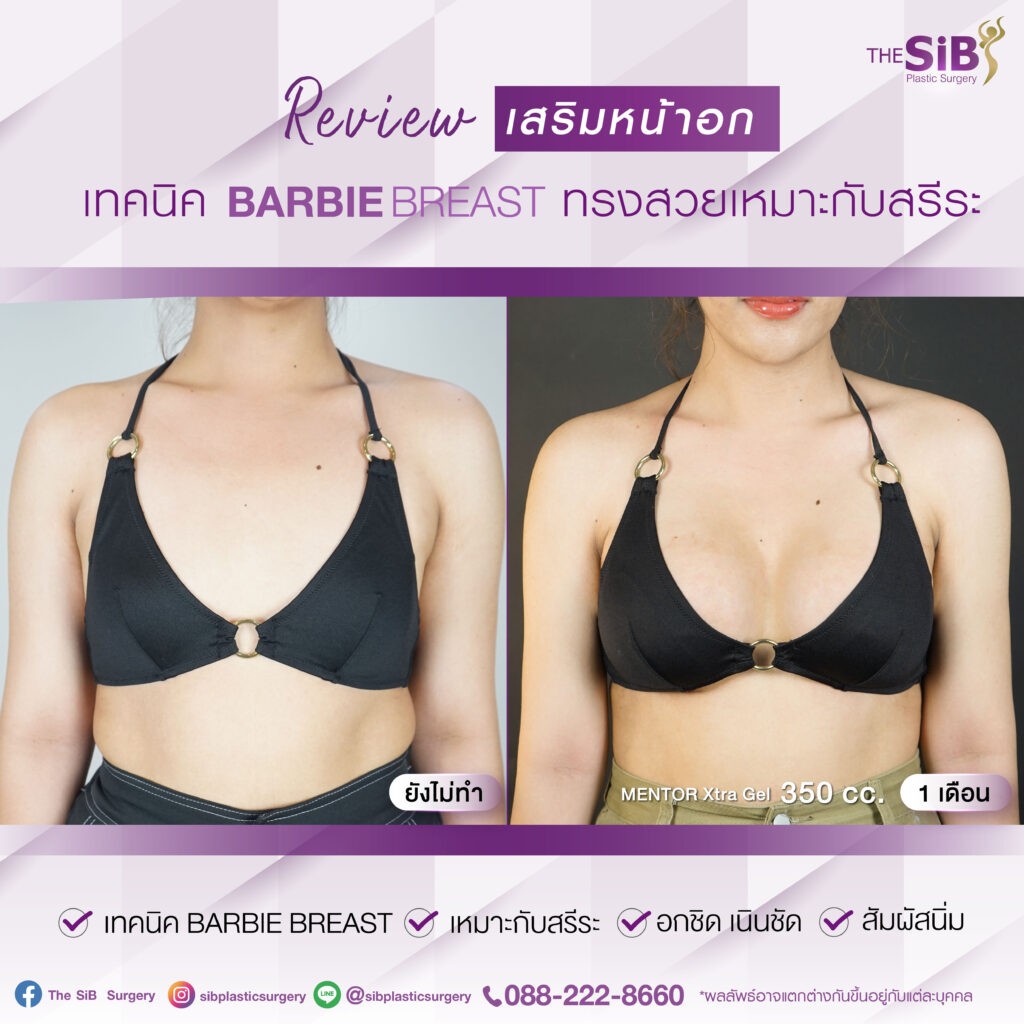 01 อกสวย อกนิ่ม อกชิด เทคนิค barbie breast