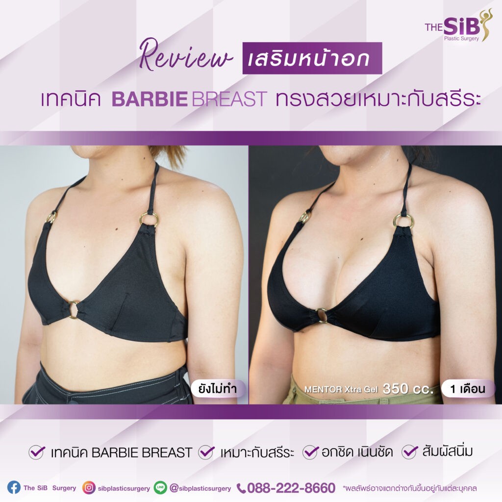 02 อกสวย อกนิ่ม อกชิด เทคนิค barbie breast