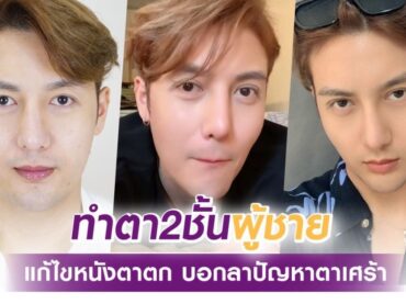 S 34922512 แก้ไขหนังตาตกลาปัญหาตาเศร้า