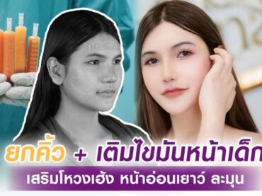 S 34922513 ยกคิ้วเติมไขมันหน้า สาว LGBQ