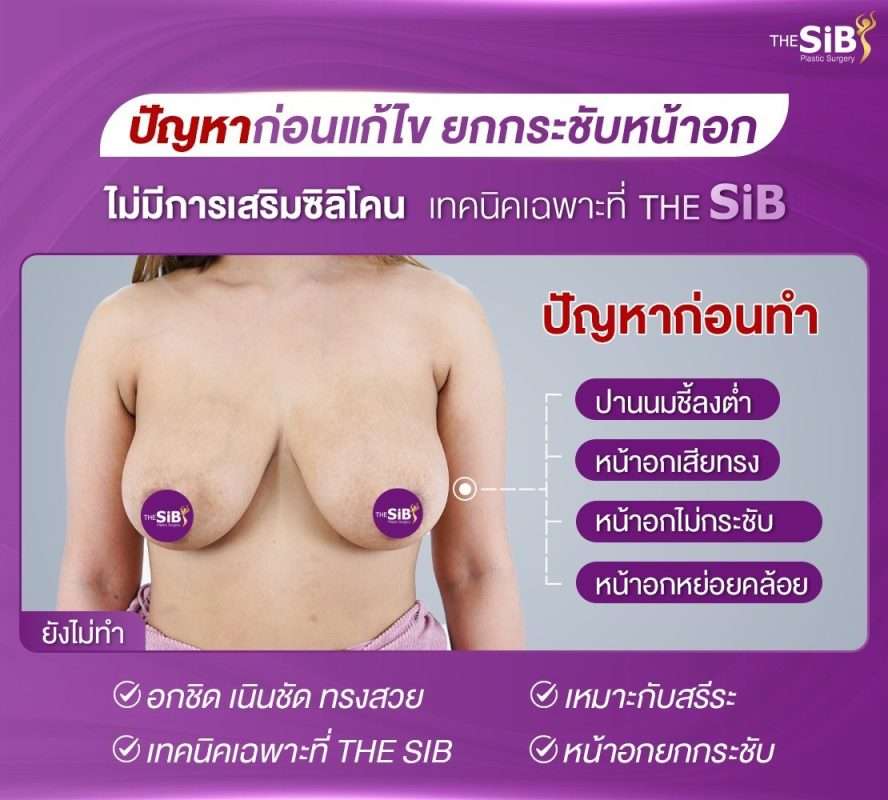 แก้หน้าอกหย่อนคล้อย อกเสียทรงไม่ได้รูป อกไม่กระชับ