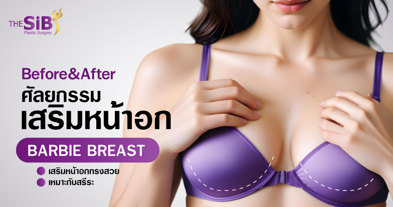 banner BEAF BARBIE BREAST Before&After_Barbie Breast