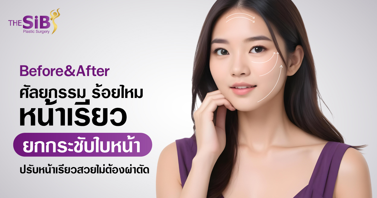 banner BEAF ร้อยไหม Before&After_ร้อยไหมหน้าเรียว