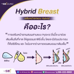 เสริมหน้าอก Hybrid Breast