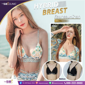 เสริมหน้าอก Hybrid Breast