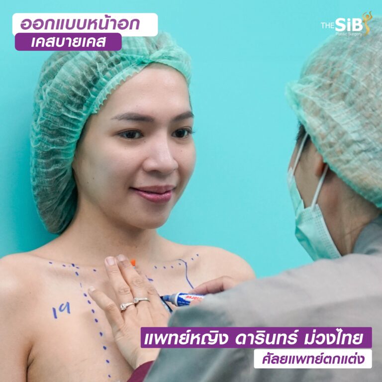 จบปัญหาหน้าอกไก่ + น้ำหนักลดลงไป 35 กิโลอย่างรวดเร็วจนทำให้หน้าอกหย่อนคล้อยสวยได้กับ คุณหมอดารินทร์