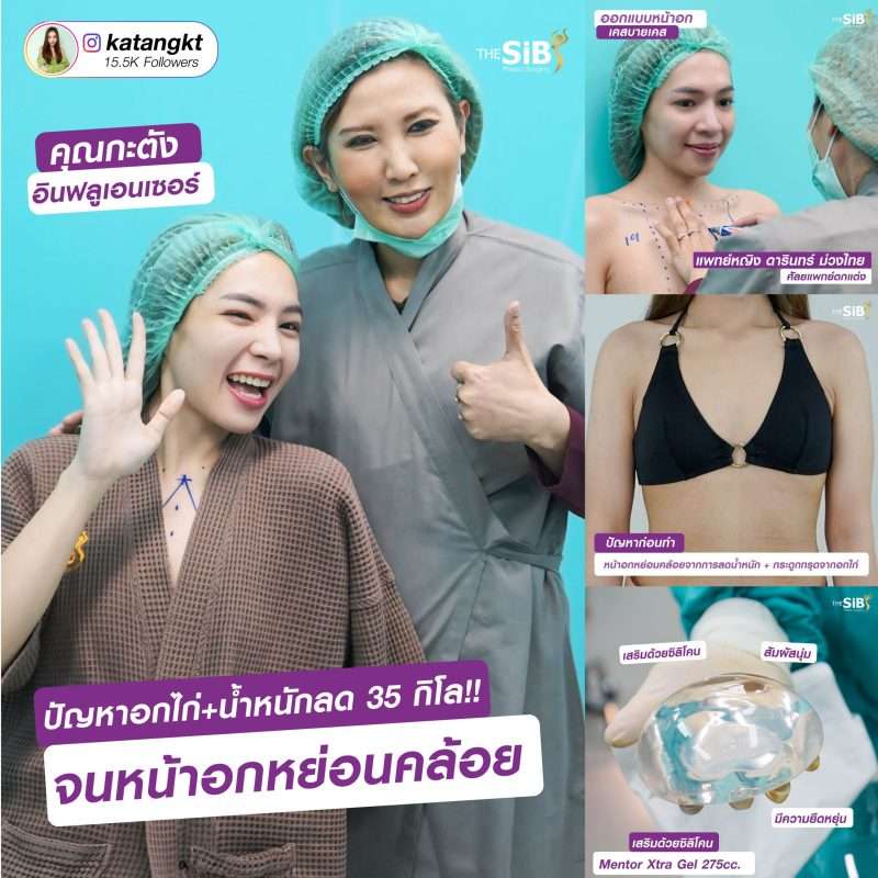 หน้าอกห่าง คืออะไร ภาวะอกไก่ เสริมหน้าอก