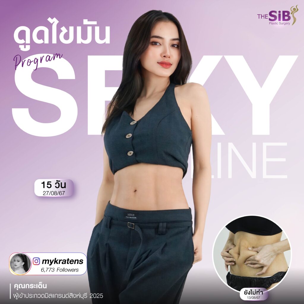 SEXYLINE 02 ดูดไขมันส่วนเกิน ปรับเอวให้เป็นเอวเอส