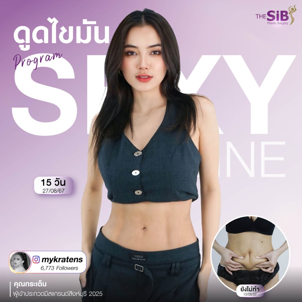 SEXYLINE 03 ดูดไขมันส่วนเกิน ปรับเอวให้เป็นเอวเอส