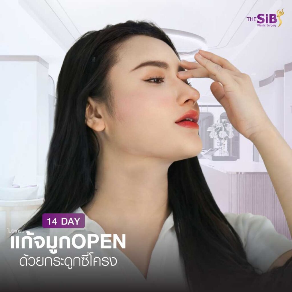 9 แก้จมูกใหม่หน้าสวยสดใส น่ารักกว่าเดิม กับคุณแอนนี่นักธุรกิจสาวไฟแรง