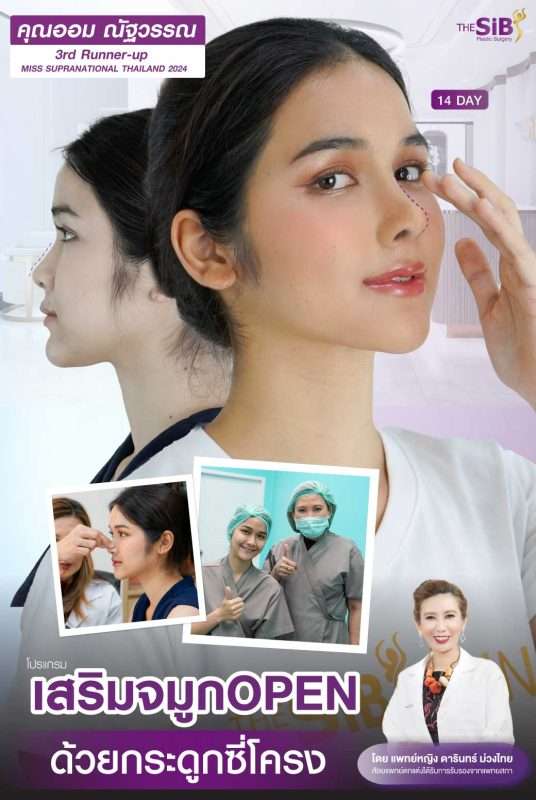 Rib Cartilage Rhinoplasty is a specialized surgical technique