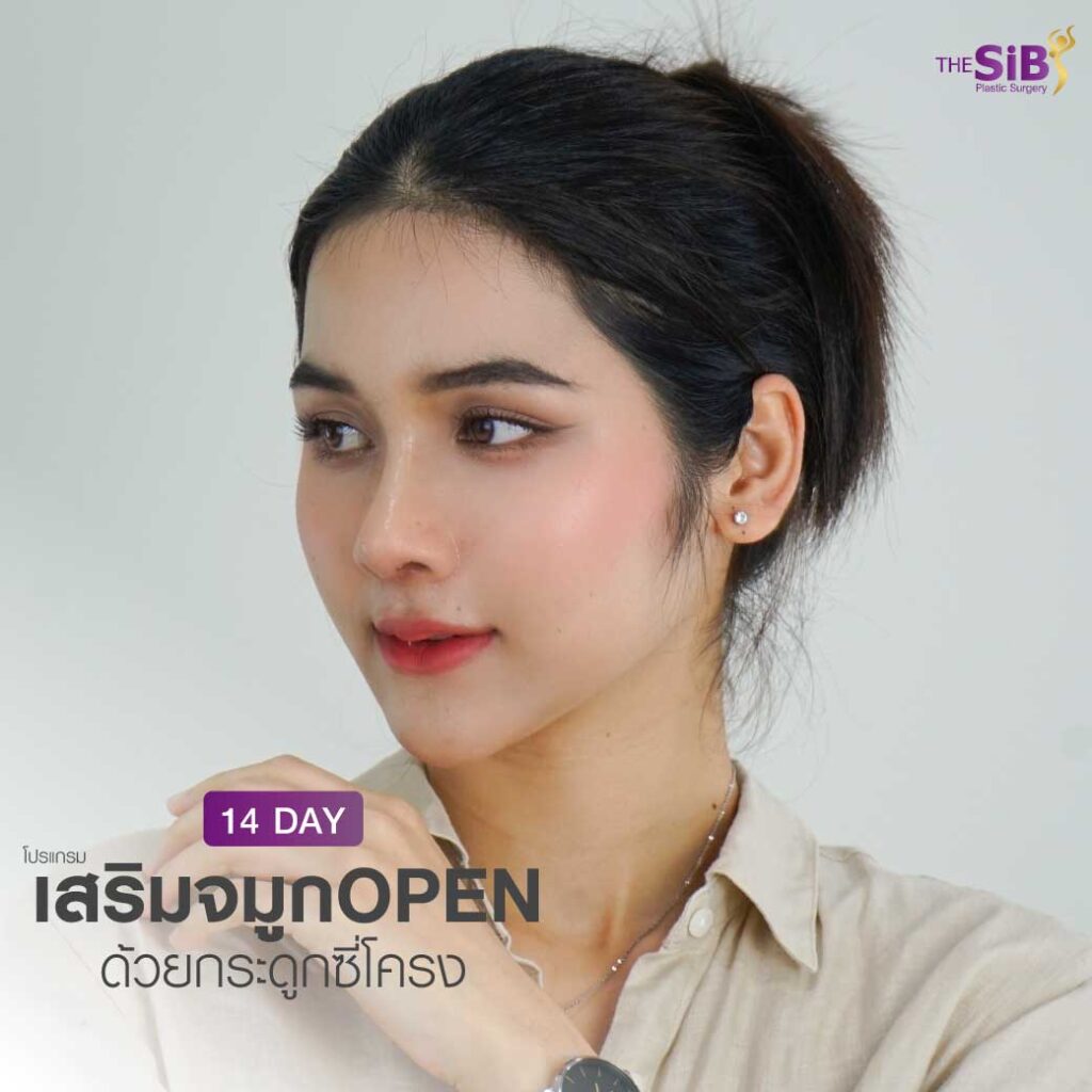 ยิงไลน์10 เสริมจมูกแบบโอเพ่น น้องออมเสริมจมูกใหม่