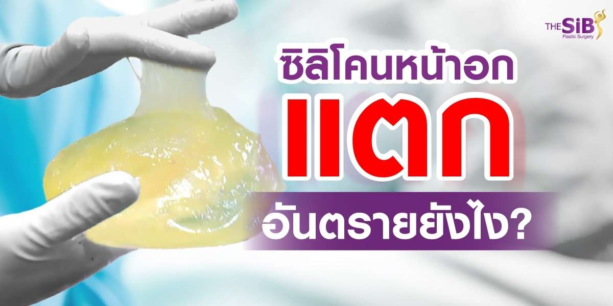 ซิลิโคนหน้าอกแตก