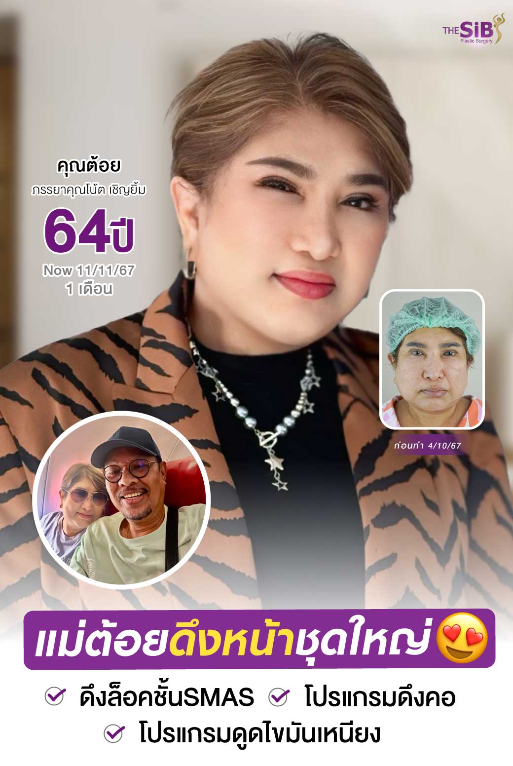 1 ศัลยกรรมดึงหน้าดึงคอคุณแม่ต้อยให้กลับมาสวยเหมือนสาว 30 อีกครั้ง