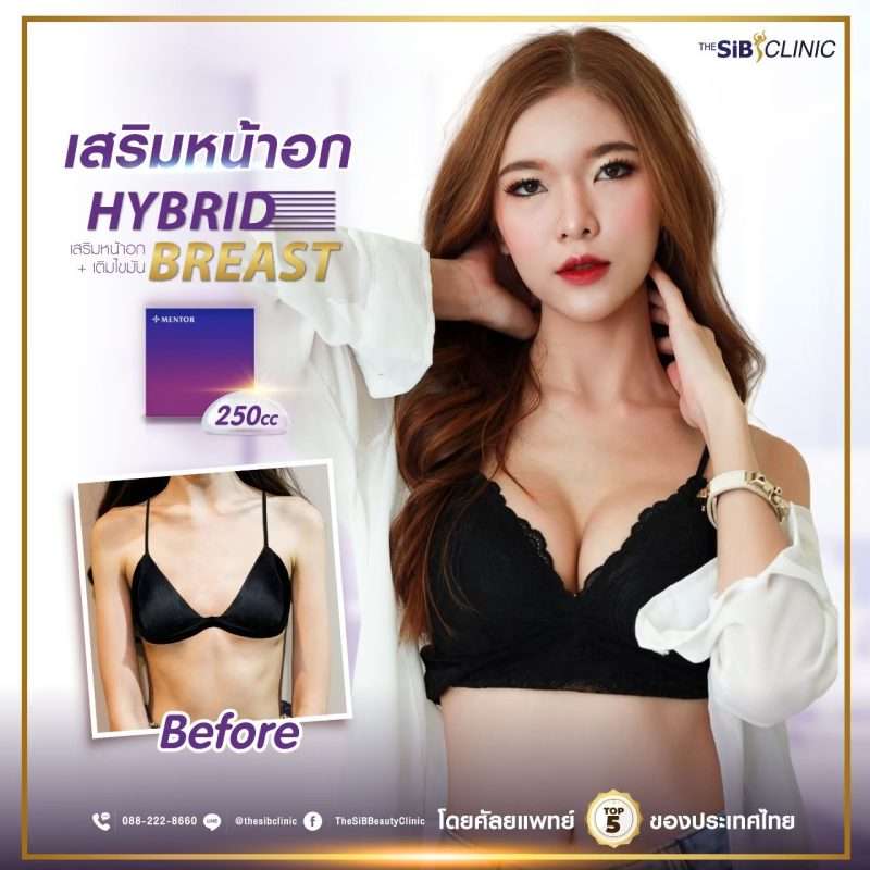 ผอมมากๆ เสริมหน้าอก