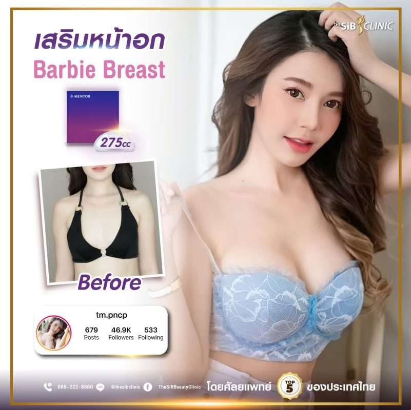 ผอมมากๆ เสริมหน้าอก