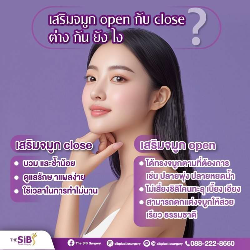 เสริมจมูกโอเพ่นคืออะไร