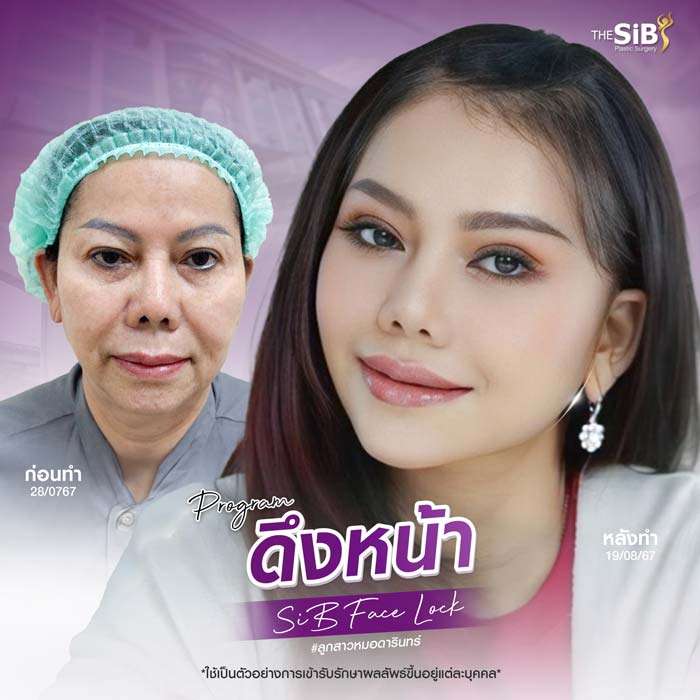 โปรโมชั่นดึงหน้า