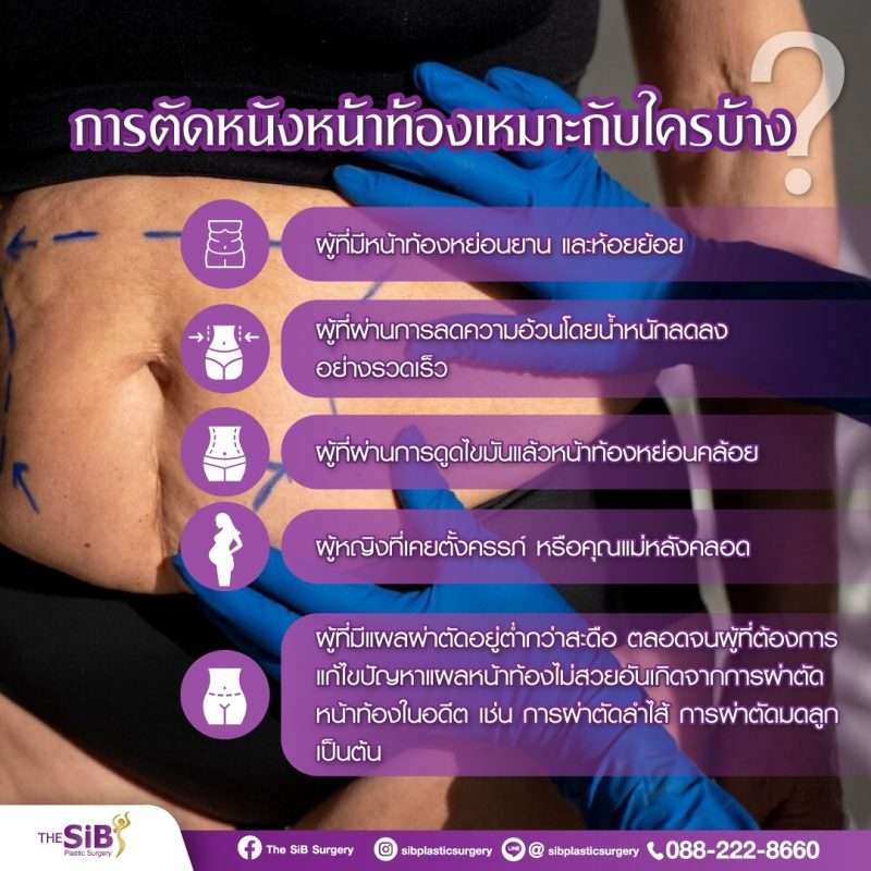 ผ่าตัดหนังหน้าท้อง ศัลยกรรมตัดฟนังหน้าท้อง