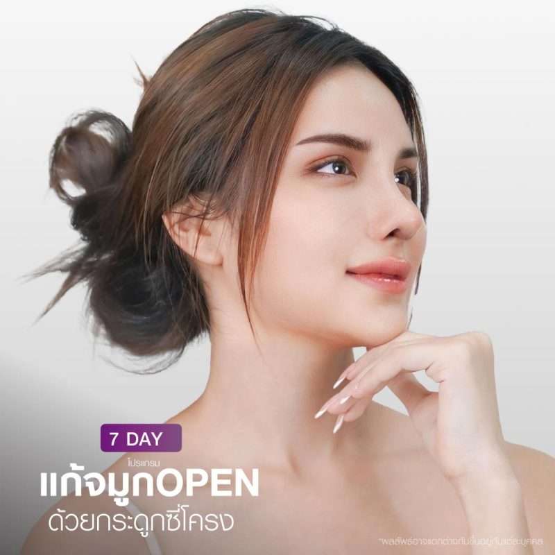 แก้จมูก open เทคนิคกระดูกอ่อนซี่โครง โดยคุณหมอดารินทร์
