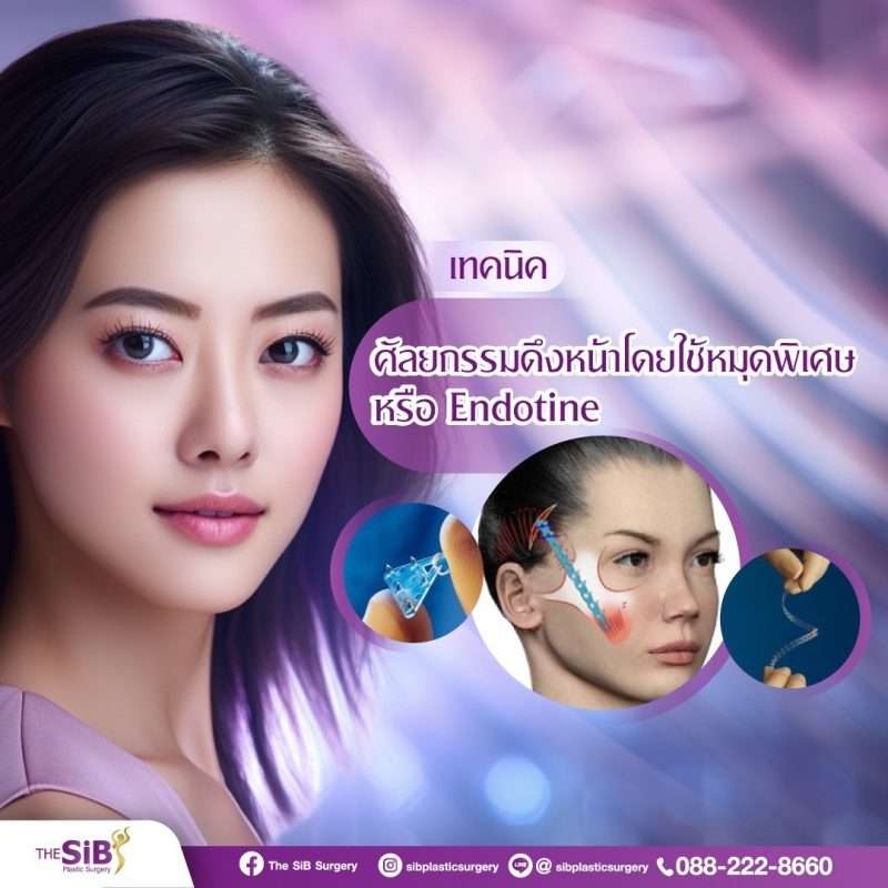 ดึงหน้าที่ไหนดี ศัลยกรรมดึงหน้า เทคนิคดึงหน้า