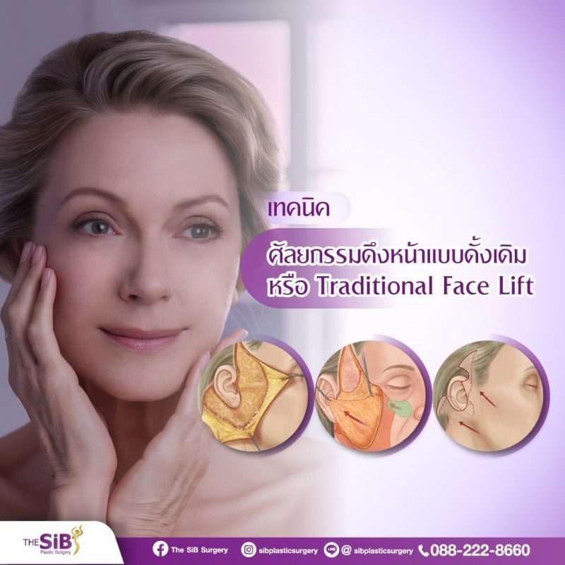 ดึงหน้าที่ไหนดี ศัลยกรรมดึงหน้า เทคนิคดึงหน้า