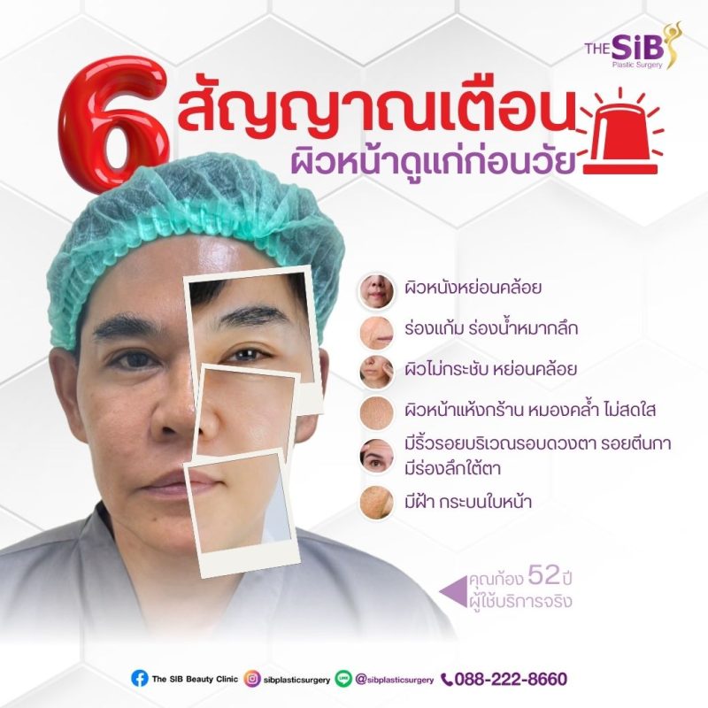 ดึงหน้า อายุเท่าไหร่