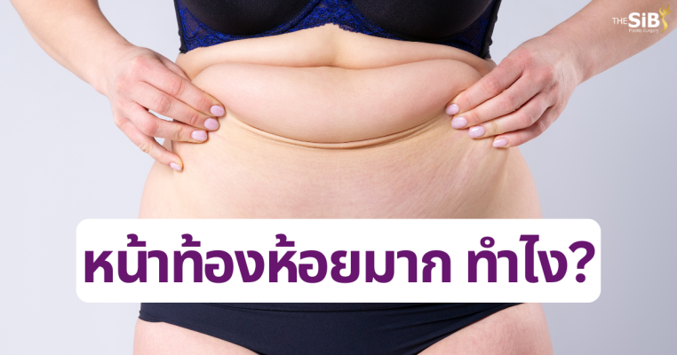 พุงย้วยหลังคลอด