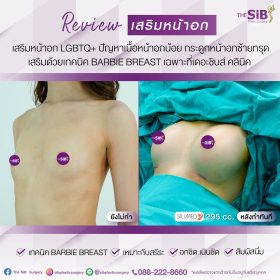 เสริมหน้าอก หลังทำทันที