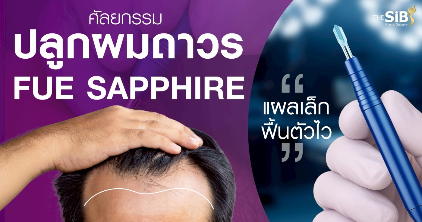 ปลูกผม FUE Sapphire คืออะไร