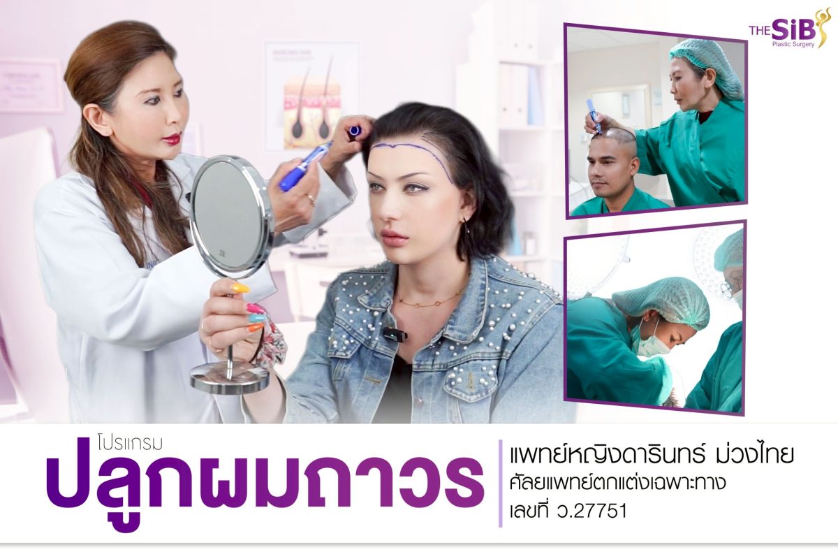 ปลูกผม FUE Sapphire