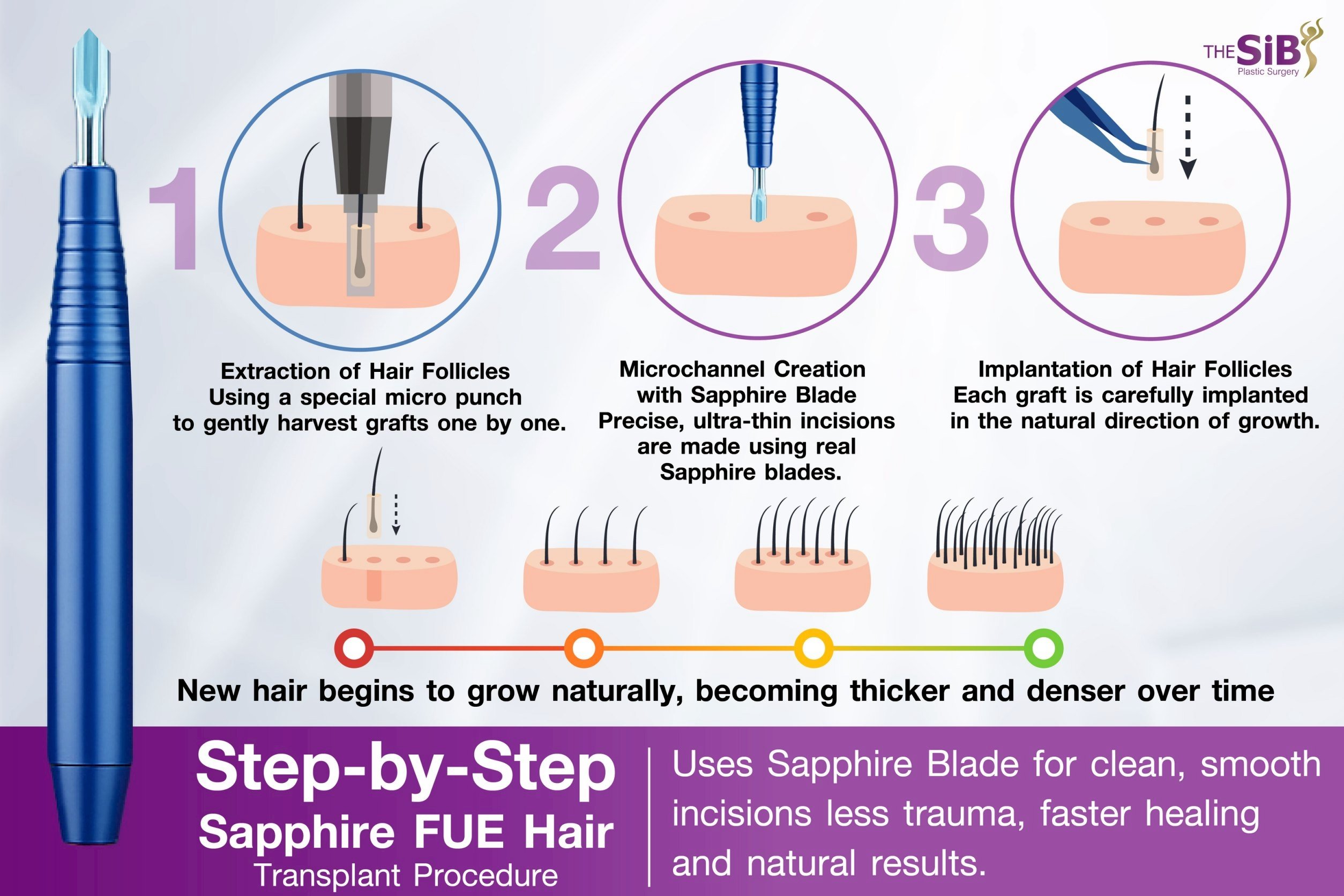 Step Hair Transplant