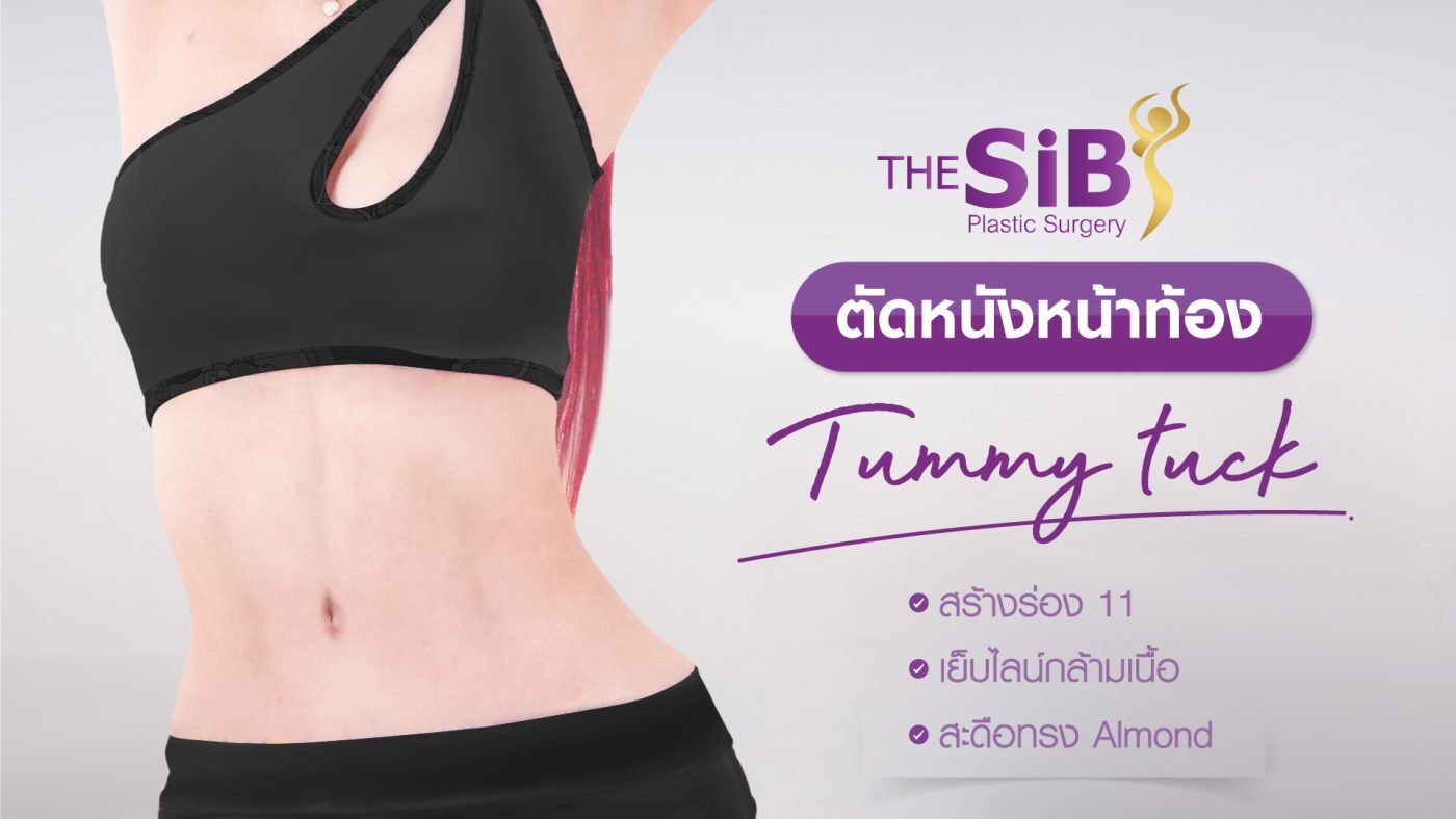 ผู้หญิงหุ่นสวยหลังตัดหนังหน้าท้องที่ The SIB Plastic Surgery