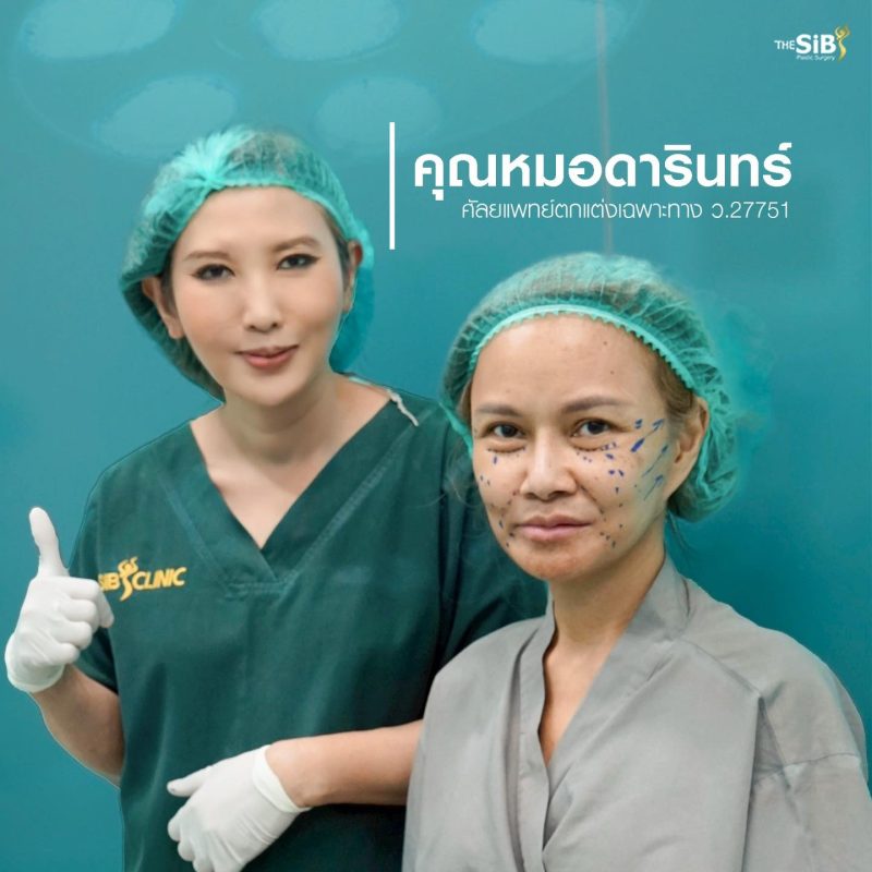 รีวิวดึงหน้า Full Facelift