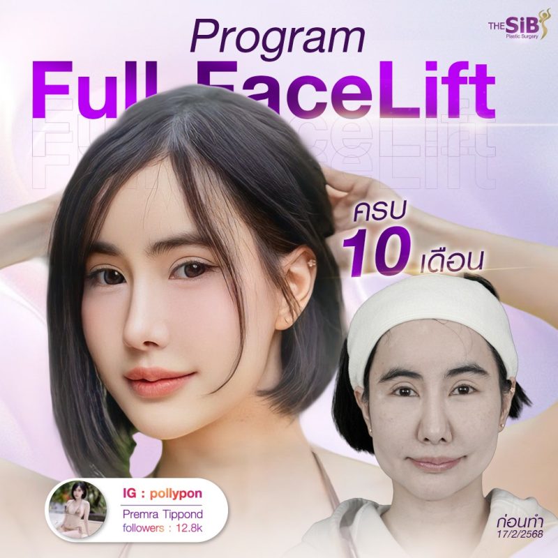 ดึงหน้าเกาหลี