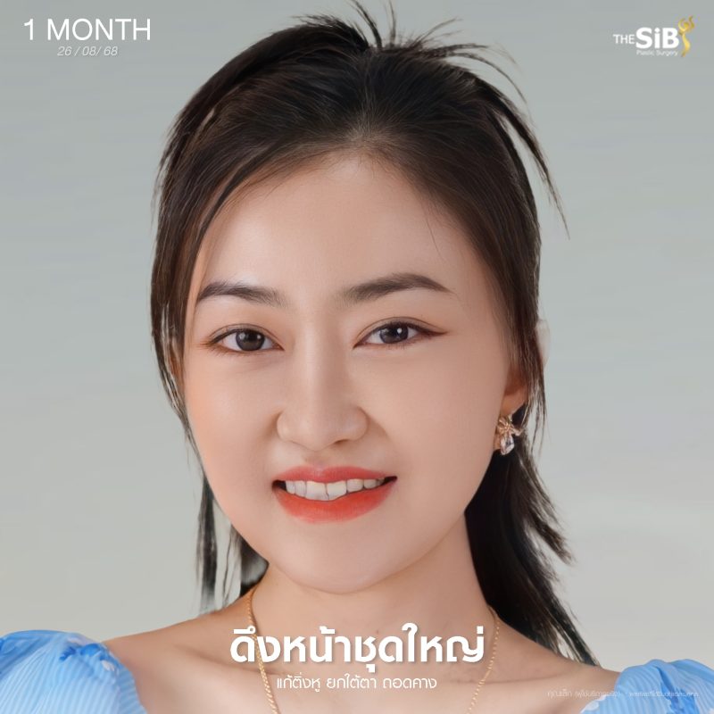 รีวิวเก้ดึงหน้า พี่เล็ก The SiB