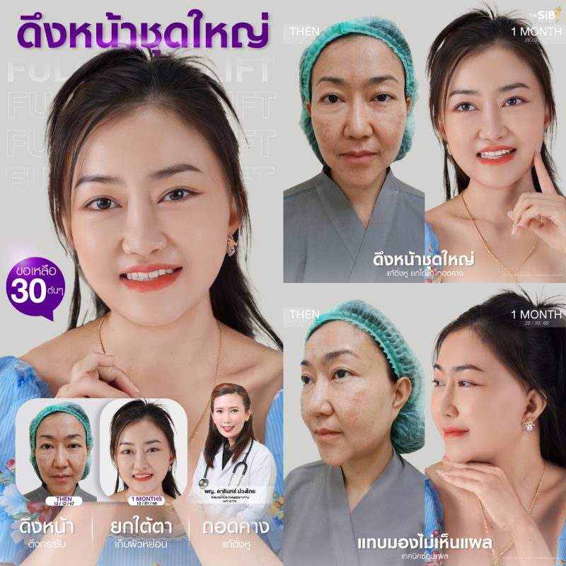 รีวิวเก้ดึงหน้า พี่เล็ก The SiB