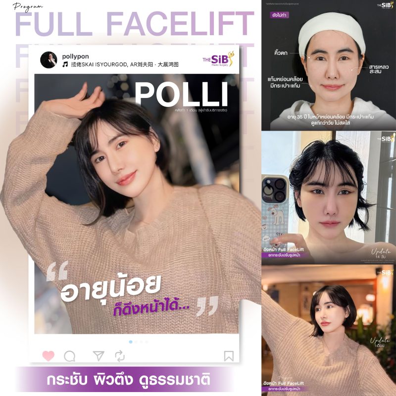 ดึงหน้าเกาหลี