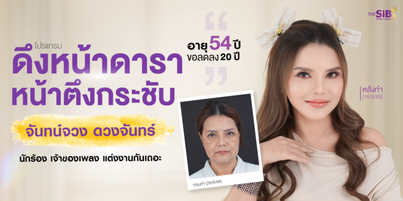 ดึงหน้าเปลี่ยนชีวิต