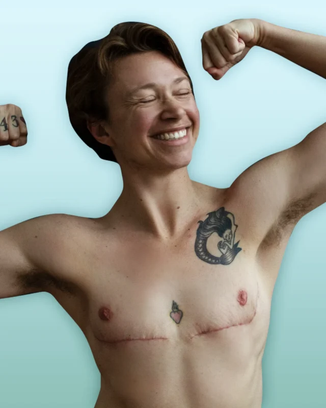 การตัดนมทอม