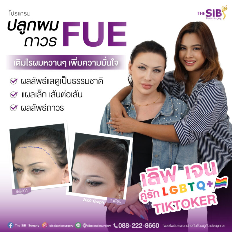 รีวิวปลูกผม LGBTQ